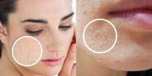 Cách làm da không bị khô vào mùa đông khiến bạn dễ chịu hơn