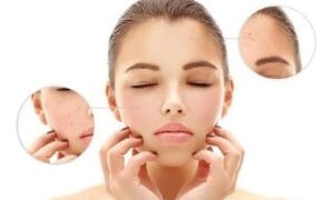Cách cấp nước cho da: Phương pháp chăm sóc hiệu quả và khoa học