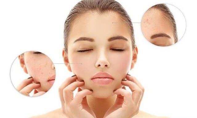 Những lưu ý khi cấp nước cho da