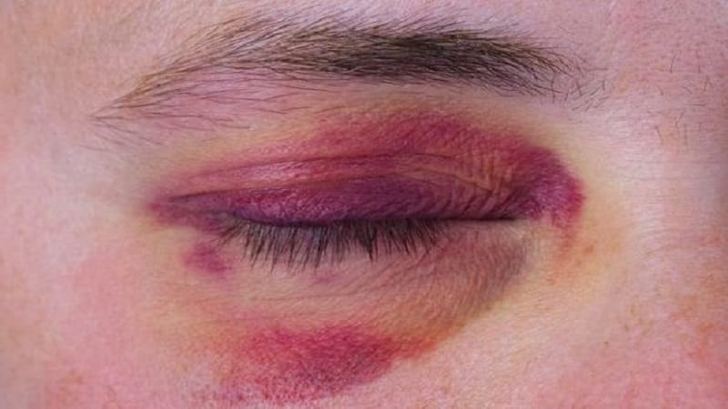 Rủi ro và tác dụng phụ