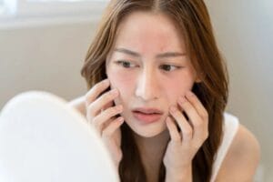 Sai lầm trong chăm sóc da trị nám và làm trắng bạn phải biết
